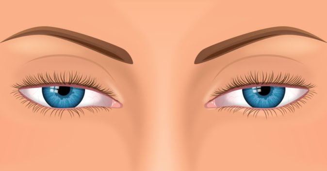 göz kapağı düşüklüğü nasıl geçer