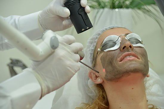 Karbon Peeling Nedir Ne İşe Yarar? | Lazer Tedavisi 1 karbon peeling nasıl yapılır fiyatları ne kadar