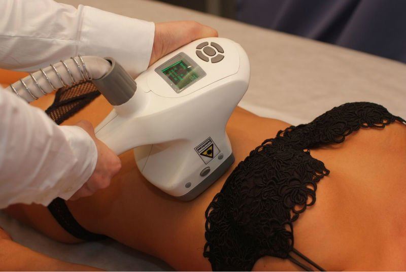 lazerle bölgesel zayıflama yöntemleri